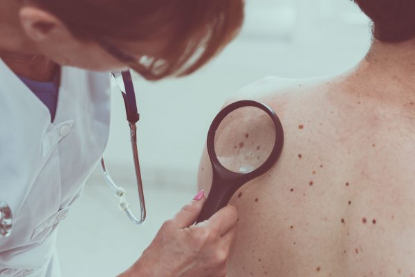 Dermatologist examining the skin on the back of a patient